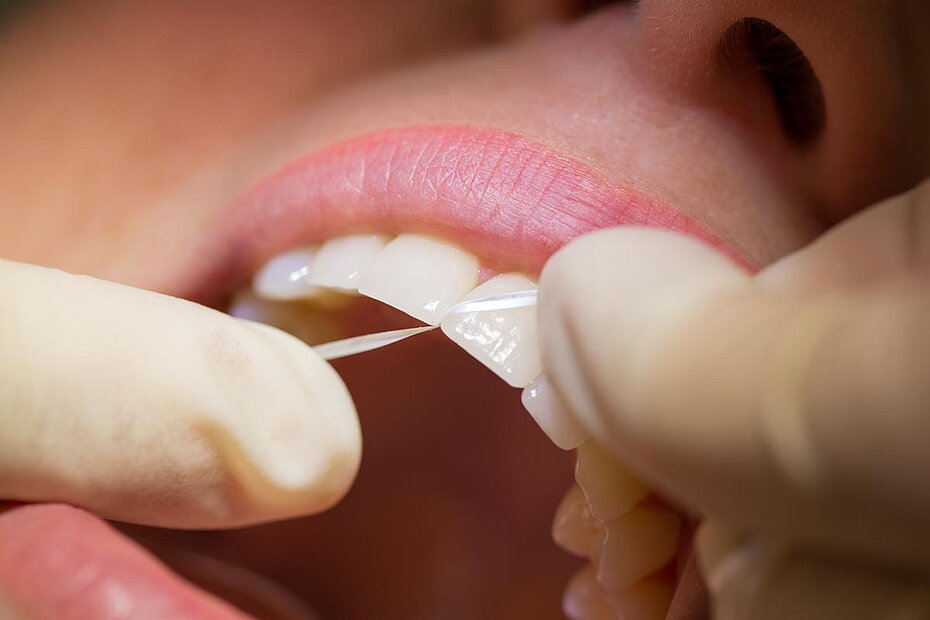 csm_zahnseide-zmtaa-hannover_8cb8a88100